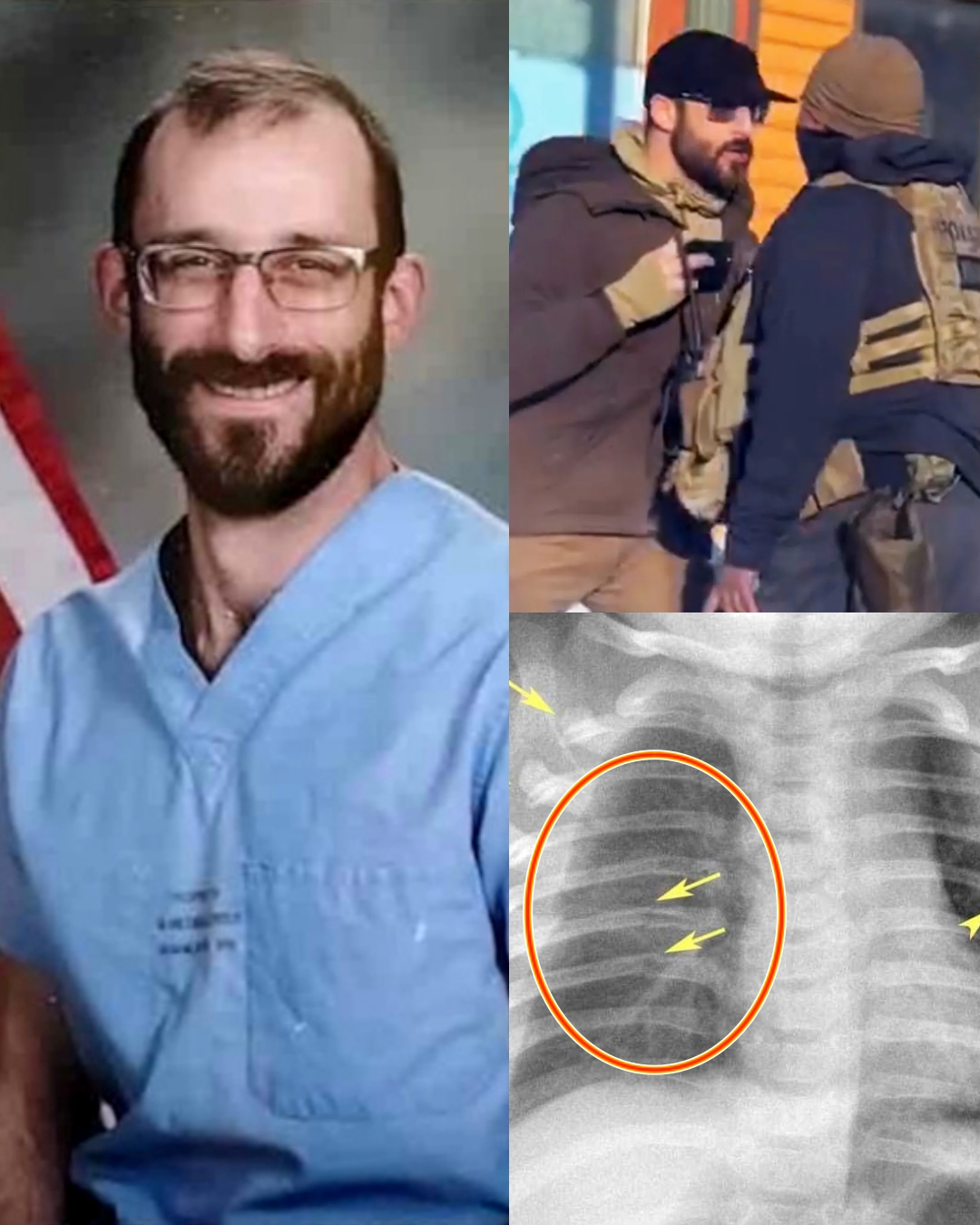 What happened before Alex Pretti died? Sources claim he was injured in a clash with federal agents, leaving him with a broken rib just one week earlier.