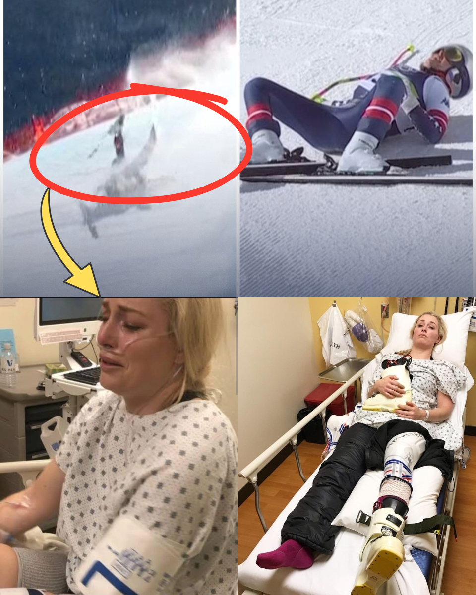 BREAKING: A Legend BROKEN! Lindsey Vonn reveals the DARK mental state behind her horror crash. Family admits: “She’s given EVERYTHING, but her body has finally SURRENDERED.