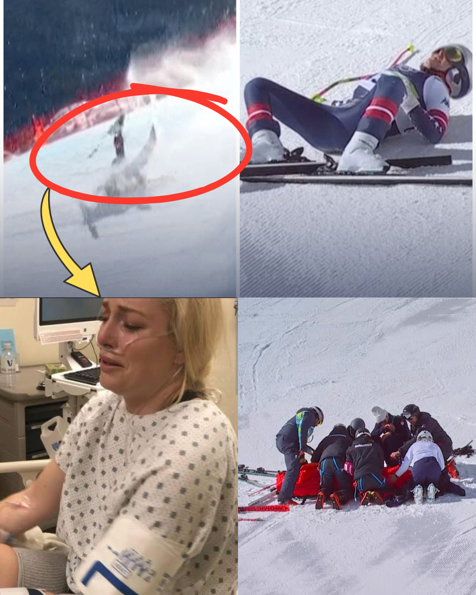 MEDICAL TRAGEDY: Lindsey Vonn’s post-surgery update leaves fans in TEARS.