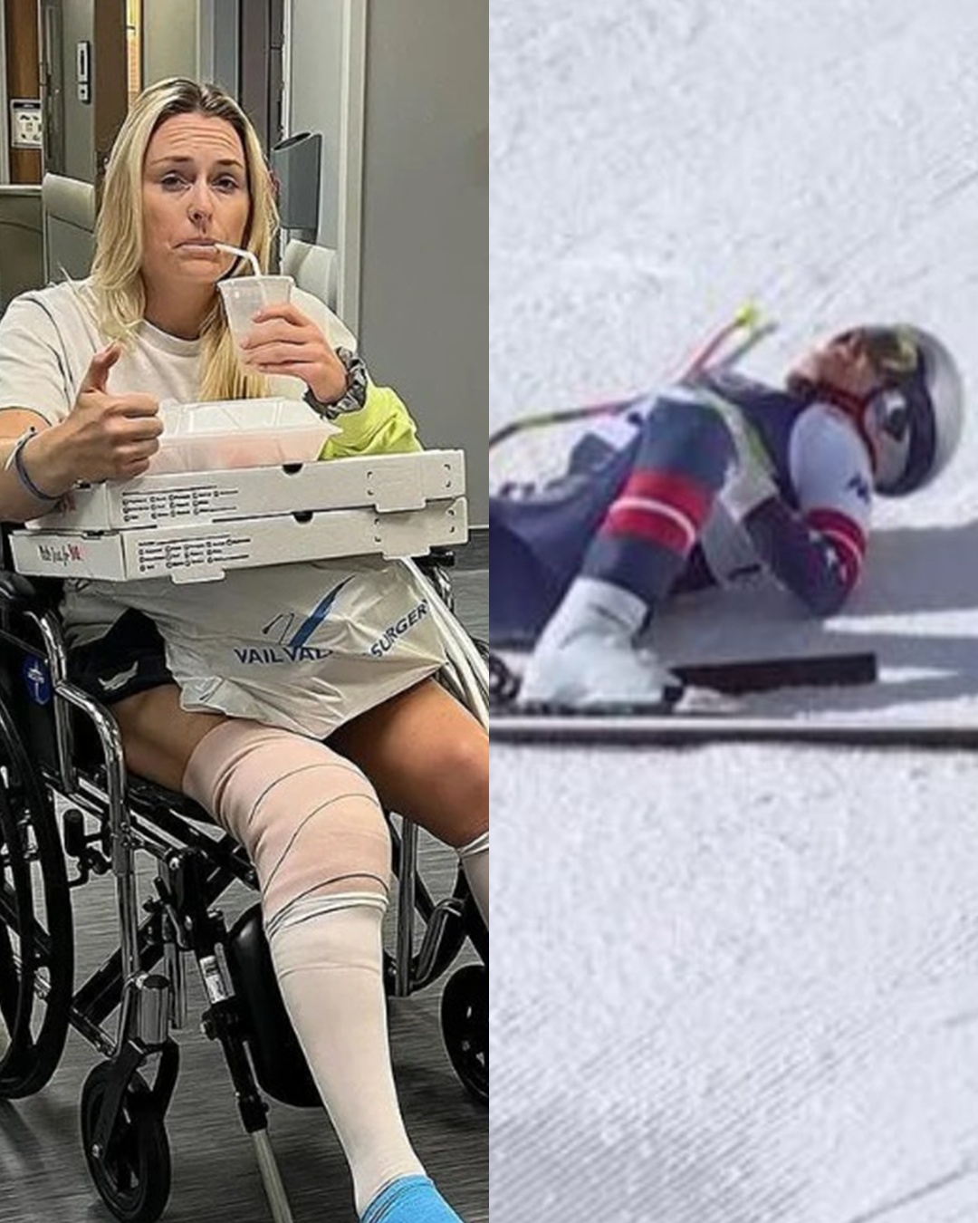 Lindsey Vonn’s injury and worrying details revealed through television cameras