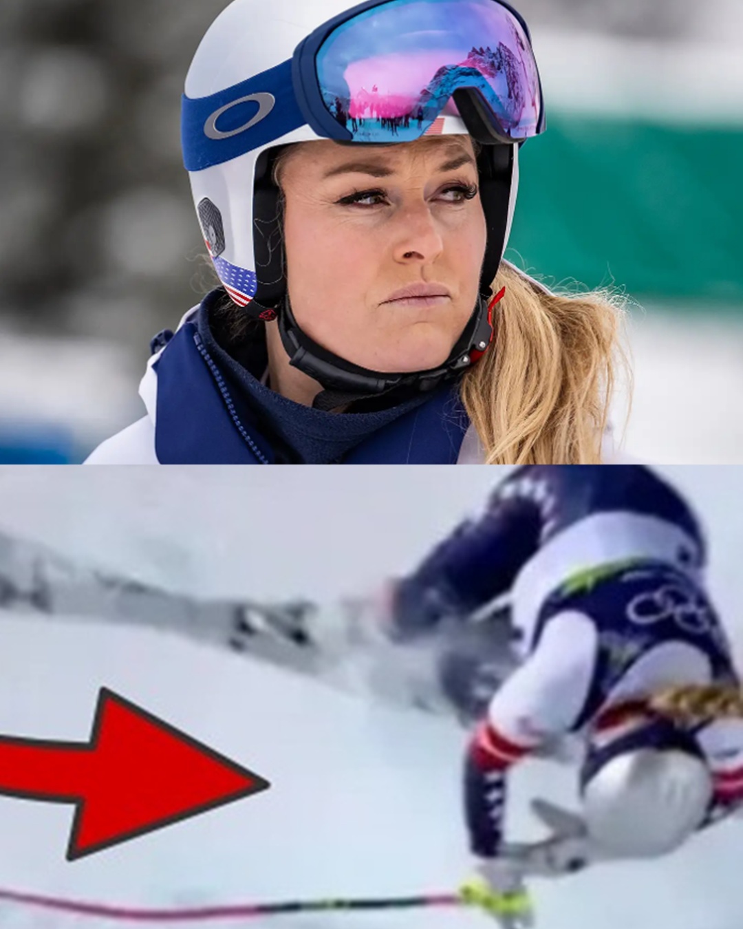 Following the horrific accident at the Olympics, skiing legend Lindsey Vonn shared her emotional journey of overcoming grief