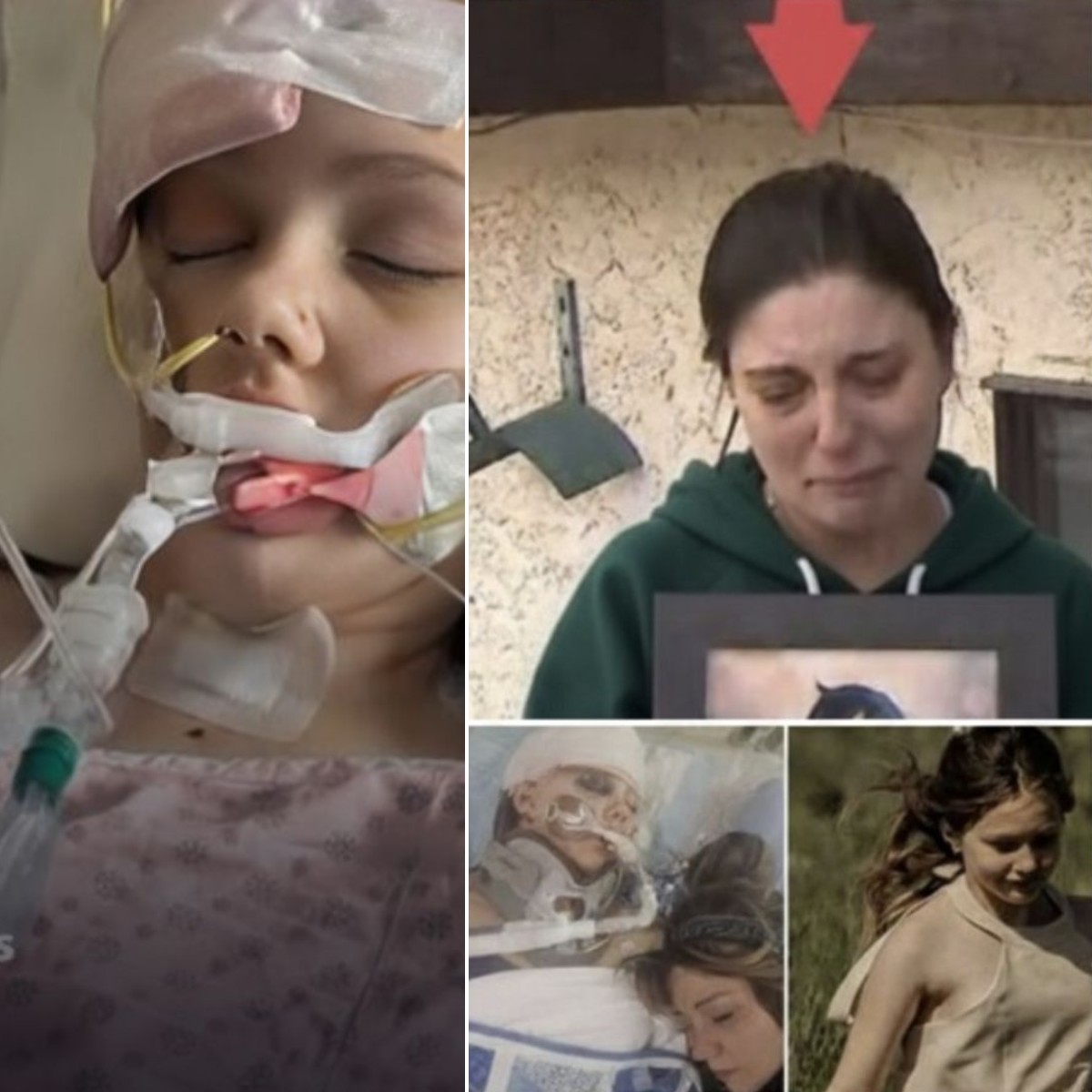 Hospital staff confirmed that just as sedation was being reduced, alarming instability forced a rapid reversal of treatment plans. Her case is now described as “hour-to-hour.”